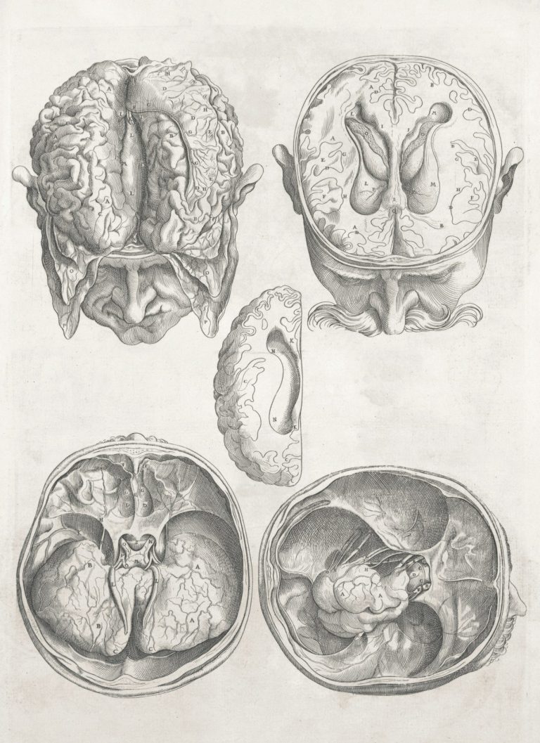Four 19th century detailed medical drawings of a man's brain inside his skull and the details of the skull with the brain removed