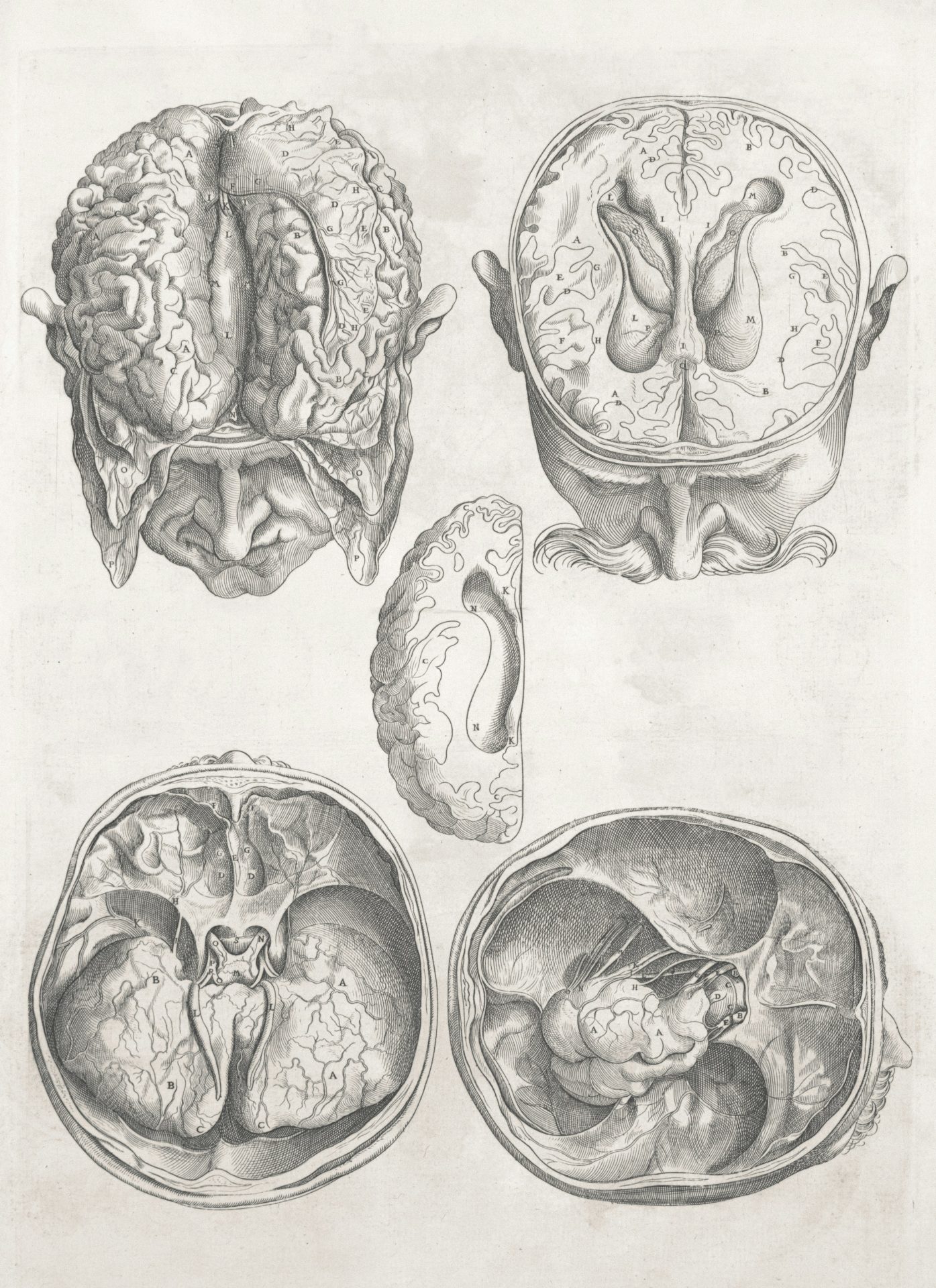Four 19th century detailed medical drawings of a man's brain inside his skull and the details of the skull with the brain removed